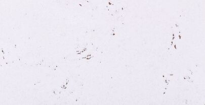 Nástěnný korek MALTA SNOW